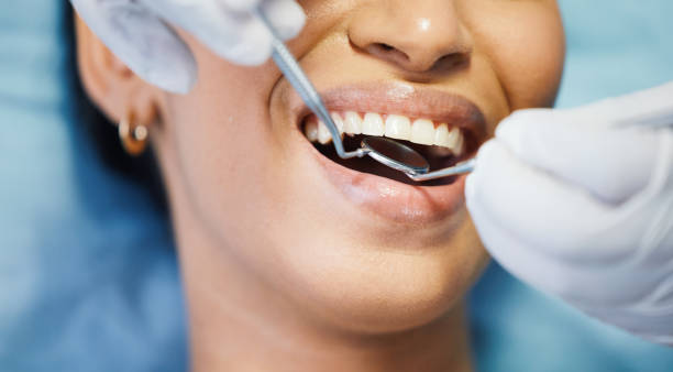 Best Urgent Care for Lost Fillings or Crowns in Grape Creek, TX